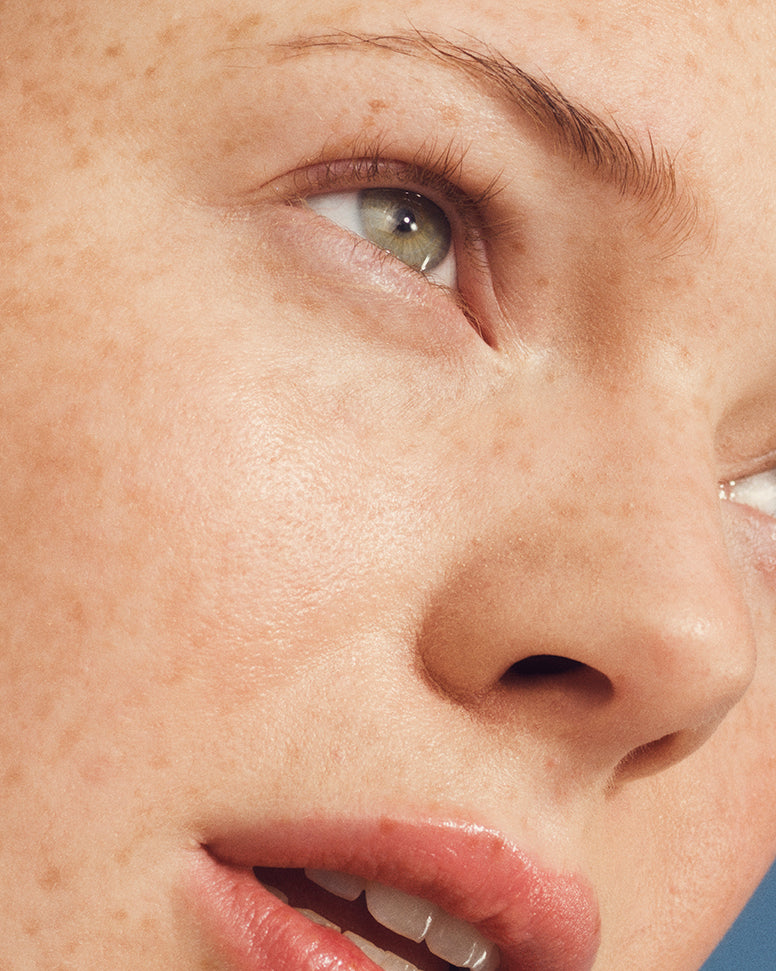 Laser Peel